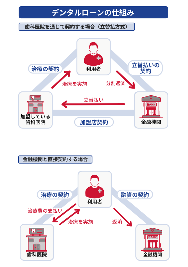 デンタルローンの仕組み